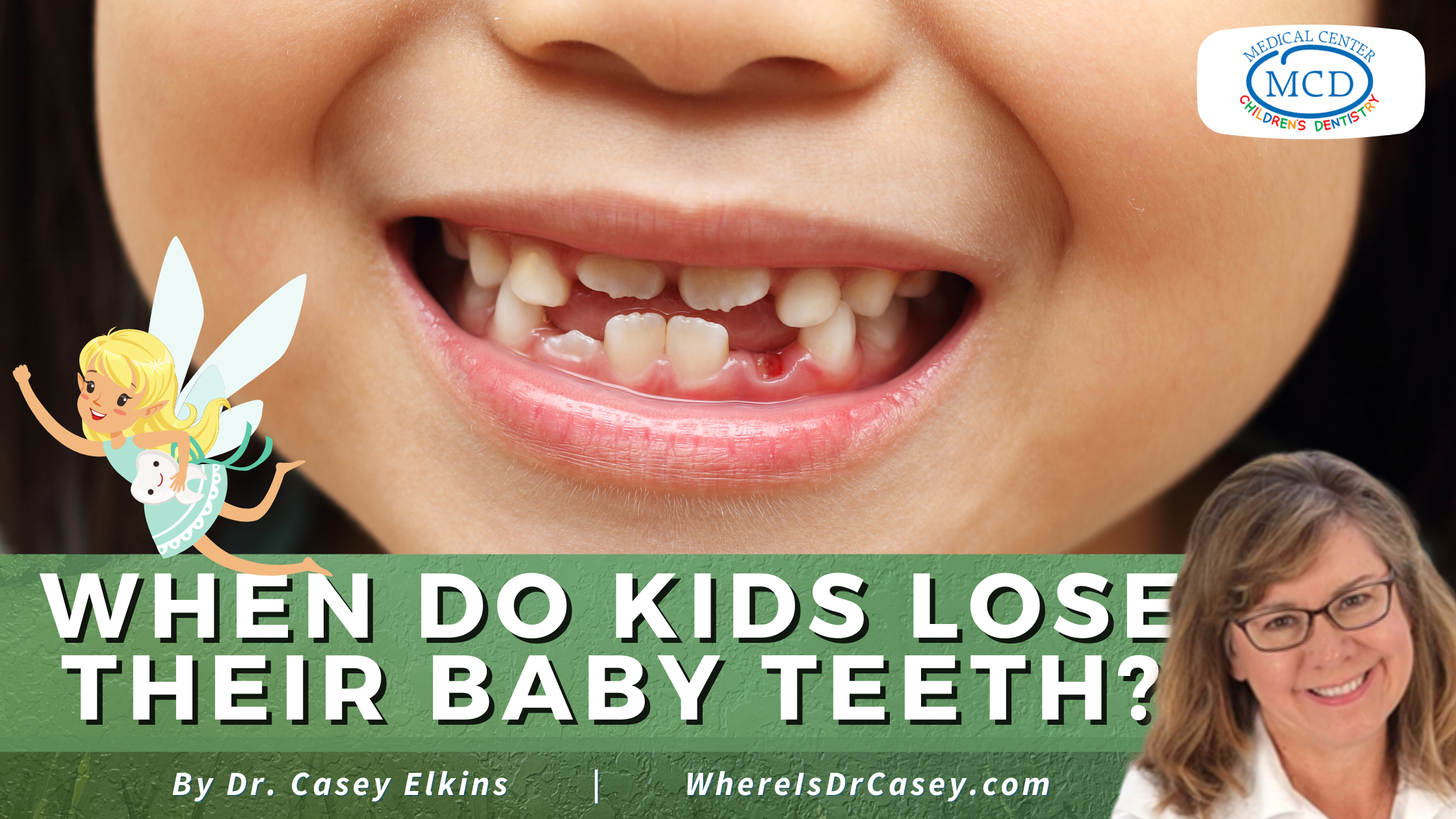 Where Is Dr Casey When Do Kids Lose Their Baby Teeth