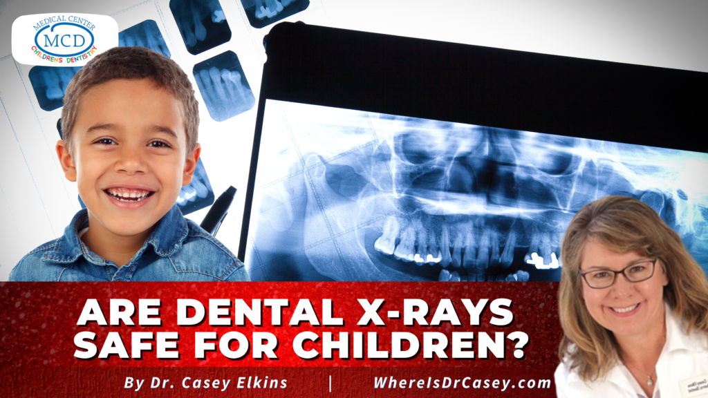 Where Is Dr Casey? Are Dental XRays Safe For Children?